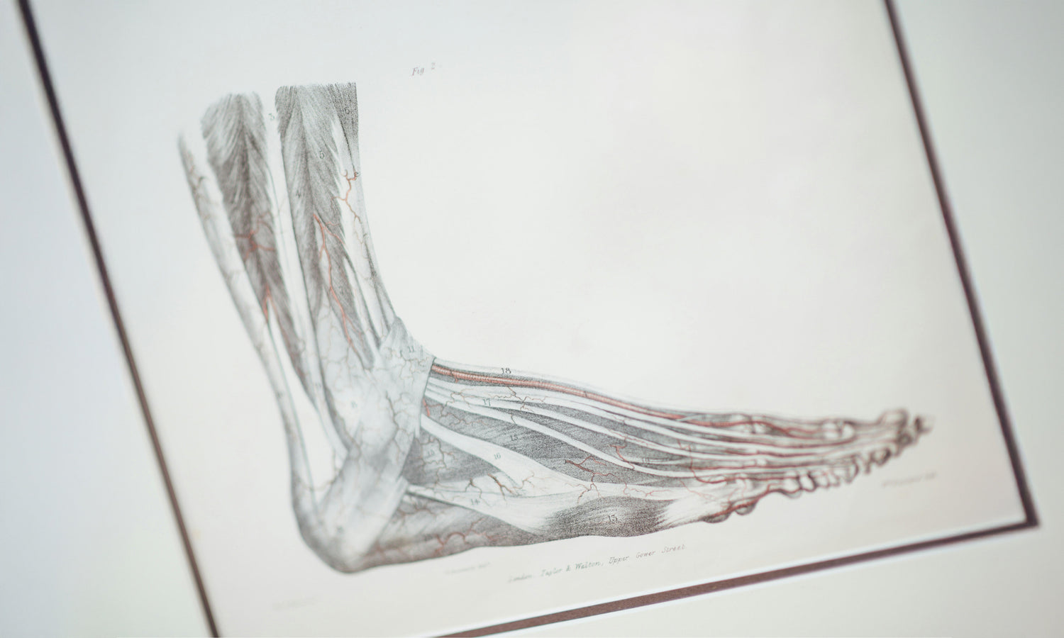 Effect of different thermal stimuli on improving microcirculation in the contralateral foot