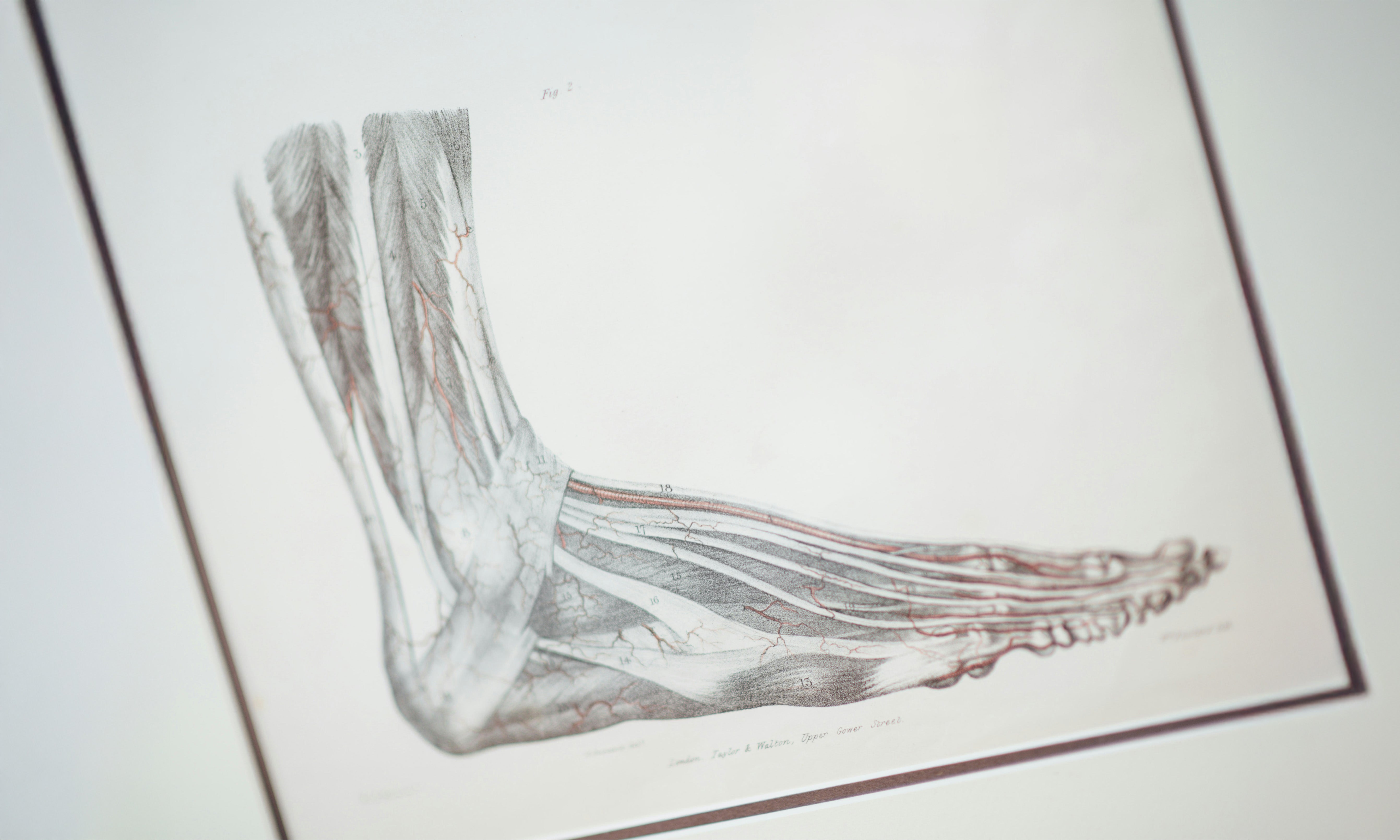 Effect of different thermal stimuli on improving microcirculation in the contralateral foot